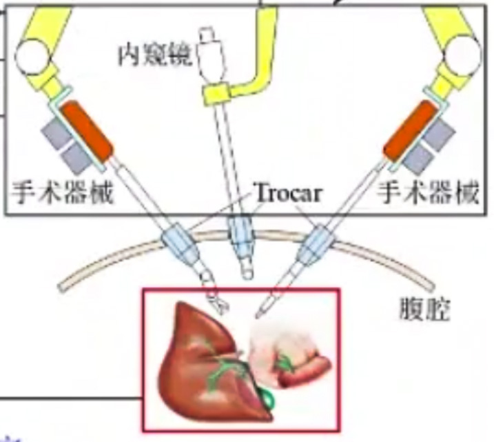 腹腔鏡手術機器人結構設計原理—AIP艾普